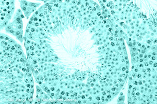Das Bild zeigt eine mikroskopische Aufnahme von einer Histologiefärbung.
