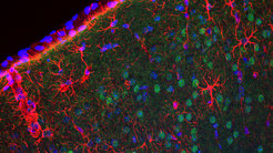 The picture shows a collection of cells under the microscope.