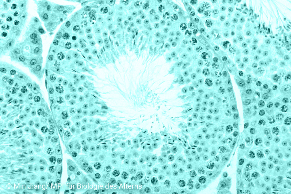 What happens in our bodies as we age?