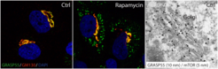 Immune fluorescence microscopy shows that the key UPS regulator, GRASP55, localizes primarily at the Golgi apparatus in non-stressed cells (left panel), whereas it readily relocalizes to secretory vesicles in response to stimuli that cause mTORC1 inhibition (middle panel). mTORC1 regulates GRASP55 directly at the Golgi, where both proteins colocalize in non-stressed cells (right panel, Image taken with the electron microscope).