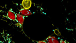 Der Parasit Toxoplasma gondii (rot) bringt die Mitochondrien (grün) dazu große Strukturen ihrer „Haut“ (gelb) abzustoßen.
