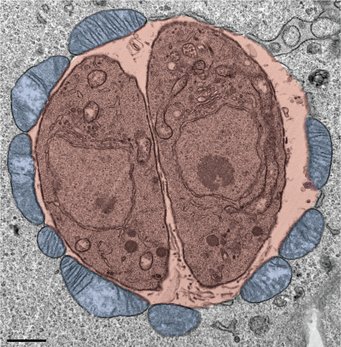 Mitochondria shed their outer membrane in response to infection