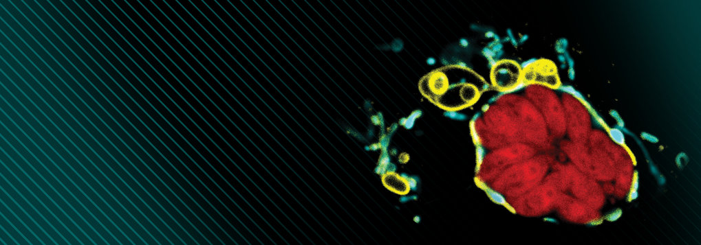 Red cell with yellow and blue structures on dark striped background.