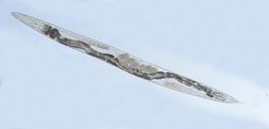 The nematode C. elegans is a popular model organism in aging research.