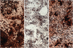 Stained calcium (dark brown) in stem cells from the bone marrow: Young stem cells (left) produce more material for bone than old stem cells (center). They can be rejuvenated by adding sodium acetate (right).