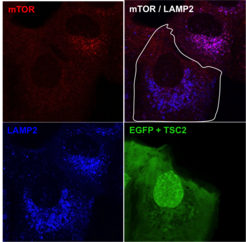 Fluorescence image of the localisation of mTOR.