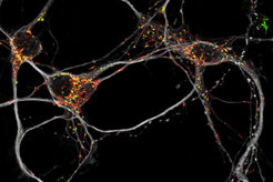 Microscopy image of mouse neurons