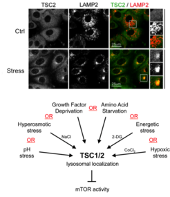 Microscopy image and overview of influences on TSC2.